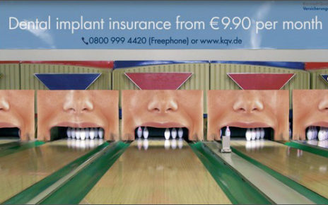 bowling alley pins dental implants